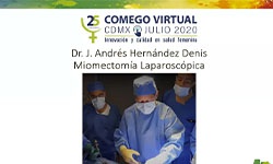 Miomectomía