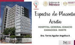 Hospital “Gral. Ignacio Zaragoza” ISSSTE