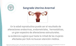 Pautas terapéuticas del SUA a lo largo del ciclo vital de la mujer: Durante la vida reproductiva