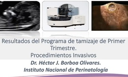 Diagnóstico invasivo de aneuploidias durante el primer trimestre