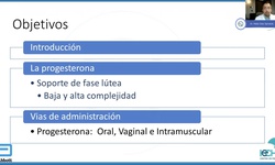 Didrogesterona en soporte de fase lutea