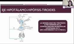Hipotiroidismo y su impacto en la fertilidad