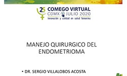 Endometrioma