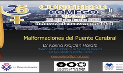 Diagnóstico fetal de las malformaciones del puente cerebral