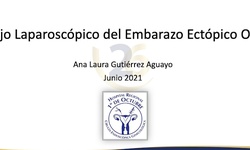 Manejo laparoscópico de embarazo ectópico ovárico