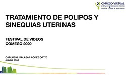 Tratamiento polipos y sinequias uterinas