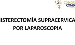Histerectomía subtotal