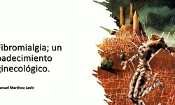 Conferencia especial: Fibromialgia y Ginecología