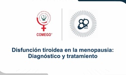 Disfunción tiroidea en la menopausia: diagnóstico y tratamiento