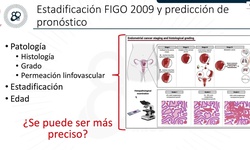 Cáncer de endometrio