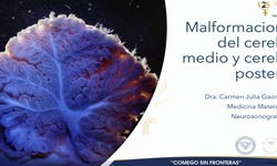 Malformaciones de cerebro medio y cerebro posterior
