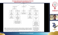 Hipotiroidismo y embarazo